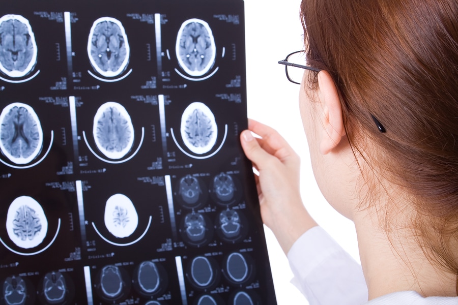 traumatic brain injuries