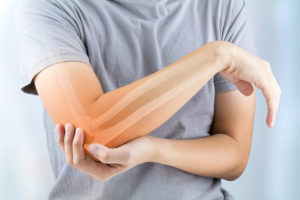 truck accident attorney in IN