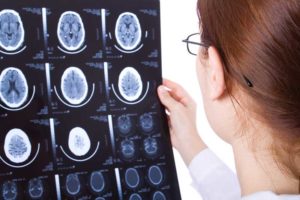 Brain Injury Lawyer Indianapolis
